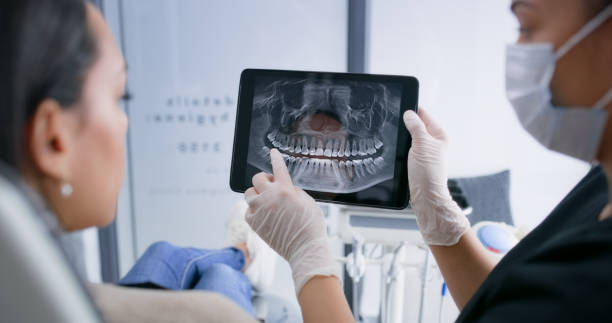Licensed Teeth Cleaning And Checkup service in Chino, CA - Smile Center Dentistry